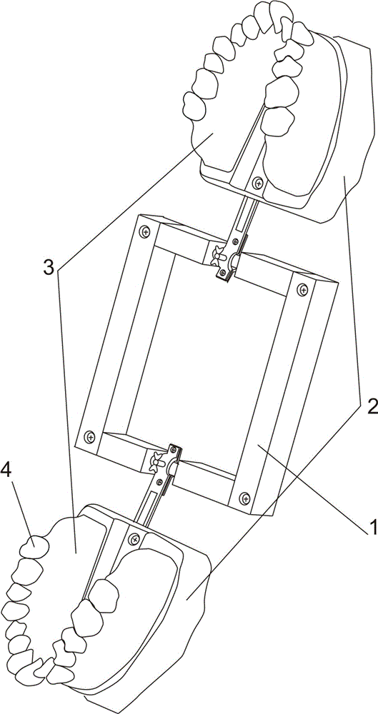 正畸操作訓(xùn)練模型的制作方法與工藝