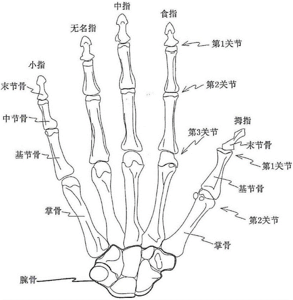 一种手指运动辅助装置的制作方法