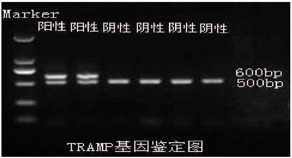 一种前列腺神经内分泌癌基因工程动物模型的构建方法及应用与流程