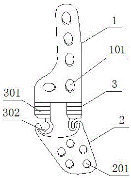 肩鎖彈性固定板的制作方法與工藝