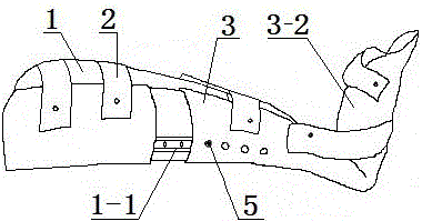 伸縮式下肢外固定支具的制作方法與工藝