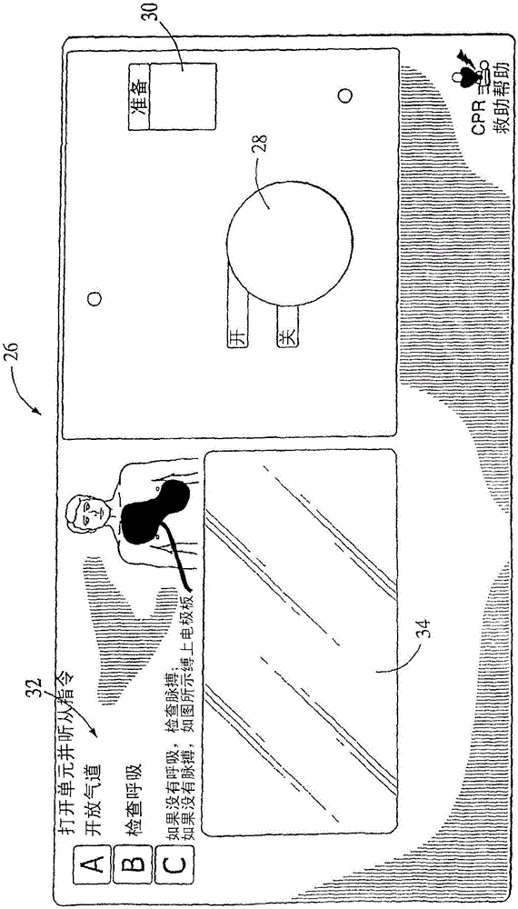 复苏设备的制作方法与工艺