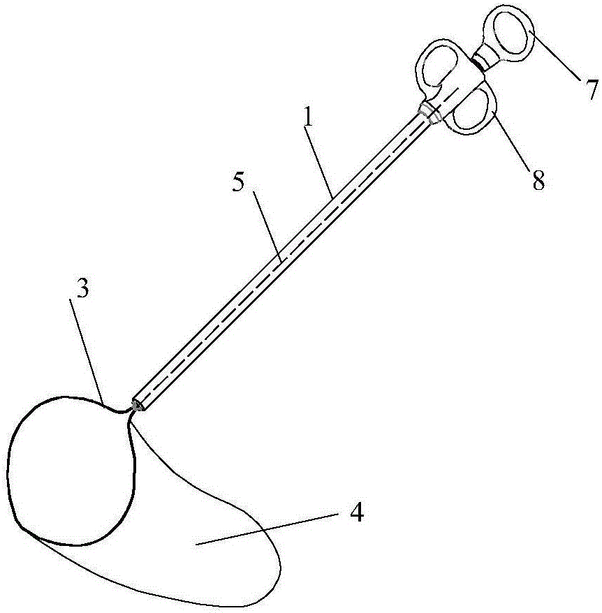 切除组织取出器的制作方法与工艺