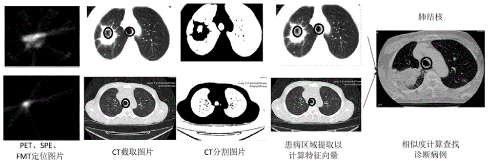 基于四模态医学影像的病例库诊断系统的制作方法与工艺