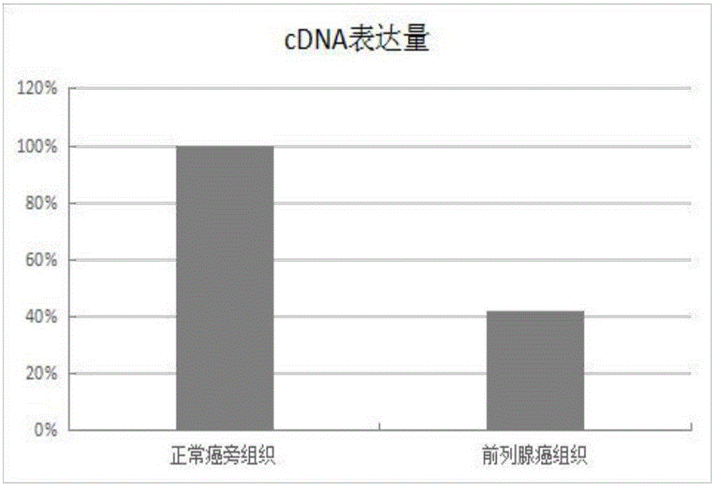 C22orf41在前列腺癌诊断标志物中的应用的制作方法与工艺