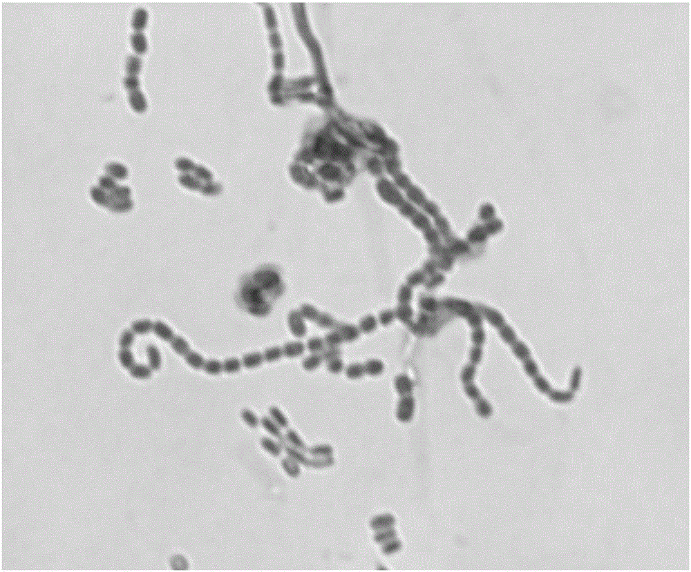 放线菌显微镜的手绘图图片