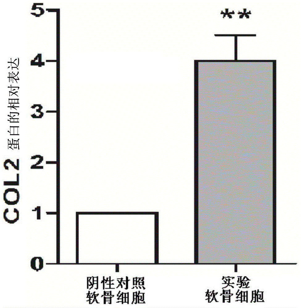 一種lncRNA-MSR的抑制劑及其應用的制作方法與工藝