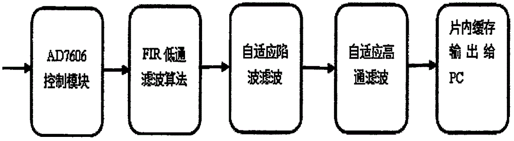 一種心電信號預處理系統(tǒng)的制作方法與工藝