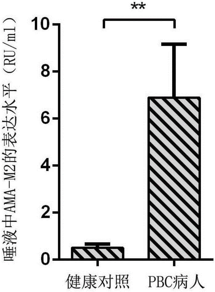 唾液抗線粒體抗體M2型的酶聯(lián)免疫檢測試劑盒的制作方法與工藝