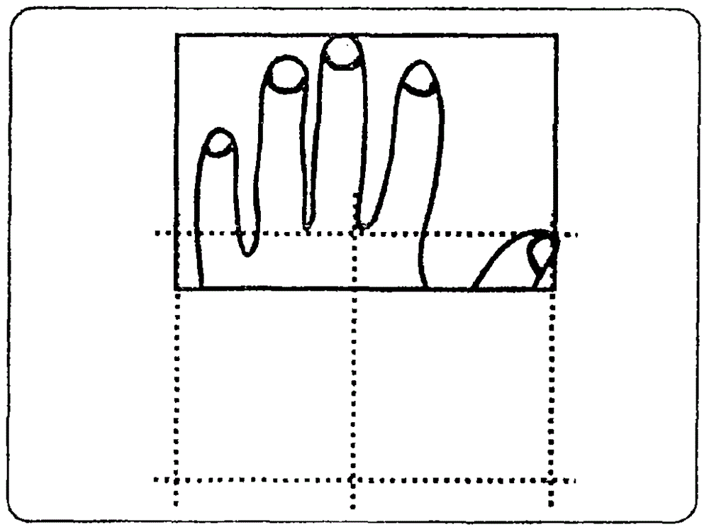 解剖學結(jié)構(gòu)局部體積的定位的制作方法與工藝