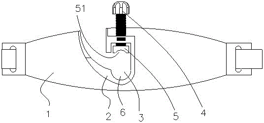 一種氣管固定器的制作方法與工藝