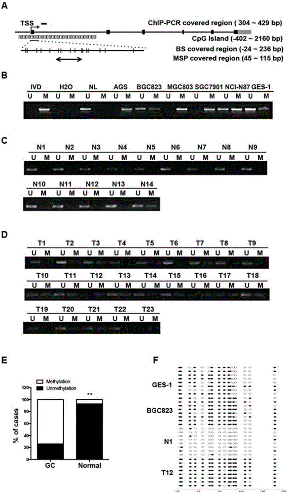 一种基于ATP4B基因体DNA的表观修饰检测引物对及试剂盒的制作方法与工艺