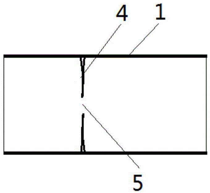 經(jīng)自然腔道內(nèi)鏡手術(shù)專用可回收覆膜支架的制作方法與工藝