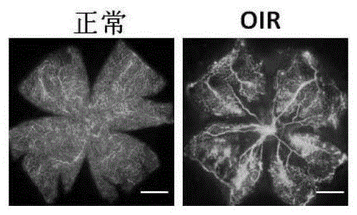 miR?329在制備預(yù)防和/或治療缺血性眼部疾病的藥物中的應(yīng)用的制作方法與工藝