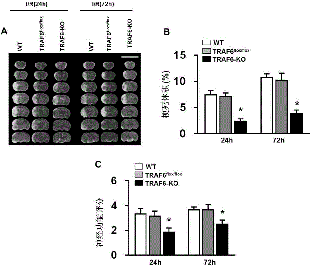 TNF受体相关因子6及其抑制剂在脑卒中疾病中的应用的制作方法与工艺