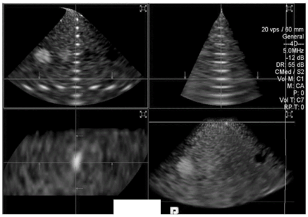 視圖方向自適應(yīng)體積超聲成像的制作方法與工藝