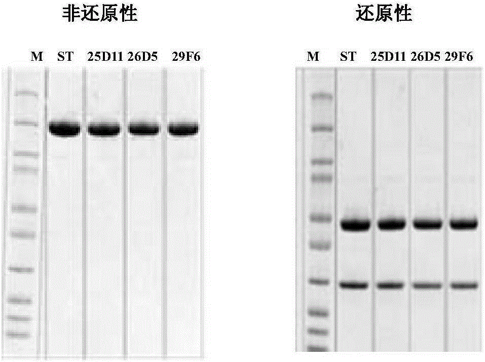 一種重組全人源抗CTLA-4單克隆抗體制劑及其應用的制造方法與工藝