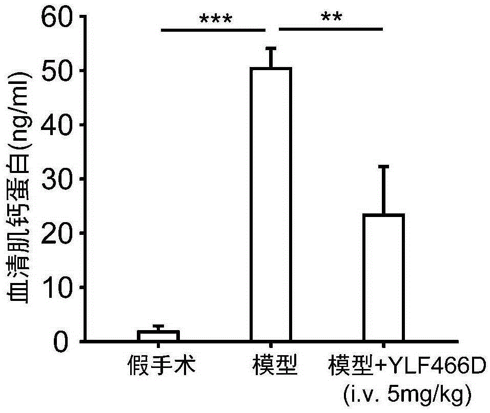 3-烯基吲哚酮类衍生物在制备治疗MIRI药物中的用途及其药物组合物的制造方法与工艺