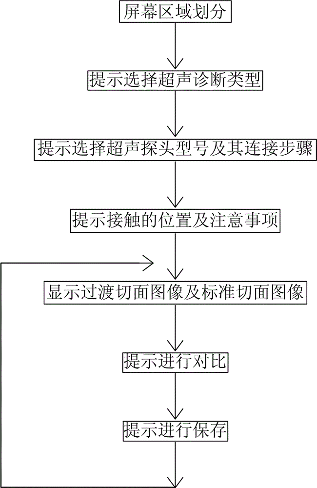 一種引導人工采集超聲波切面圖像的方法與制造工藝