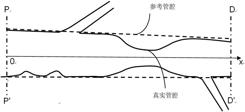 基于CFD仿真的分叉血管压力差及FFR的快速计算方法及系统与制造工艺