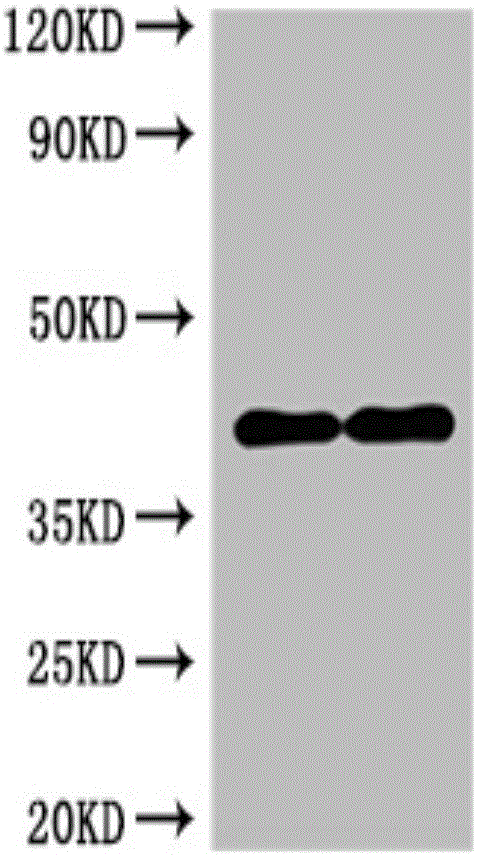 一种膜蛋白CD14的抗体的制备方法及应用与制造工艺