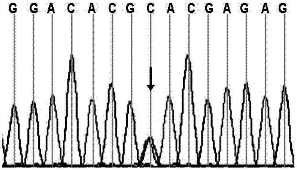 ABCA3基因在检测先天性CCMC中的应用的制作方法