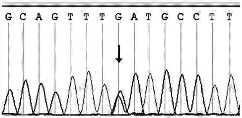 ABCA3基因的应用的制作方法