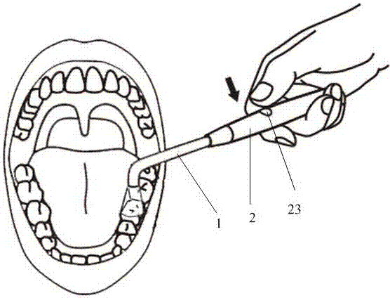 一种龋齿探测仪的制作方法