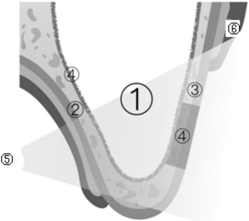 一种辅助确定上颌窦外侧壁轮廓的方法与流程