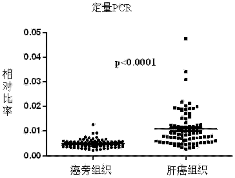 用于抑制高表达FAK基因的肝细胞癌细胞的siRNA及其应用的制作方法