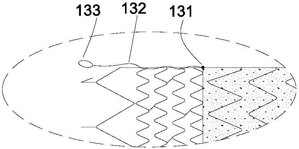 管腔支架及其输送系统的制作方法