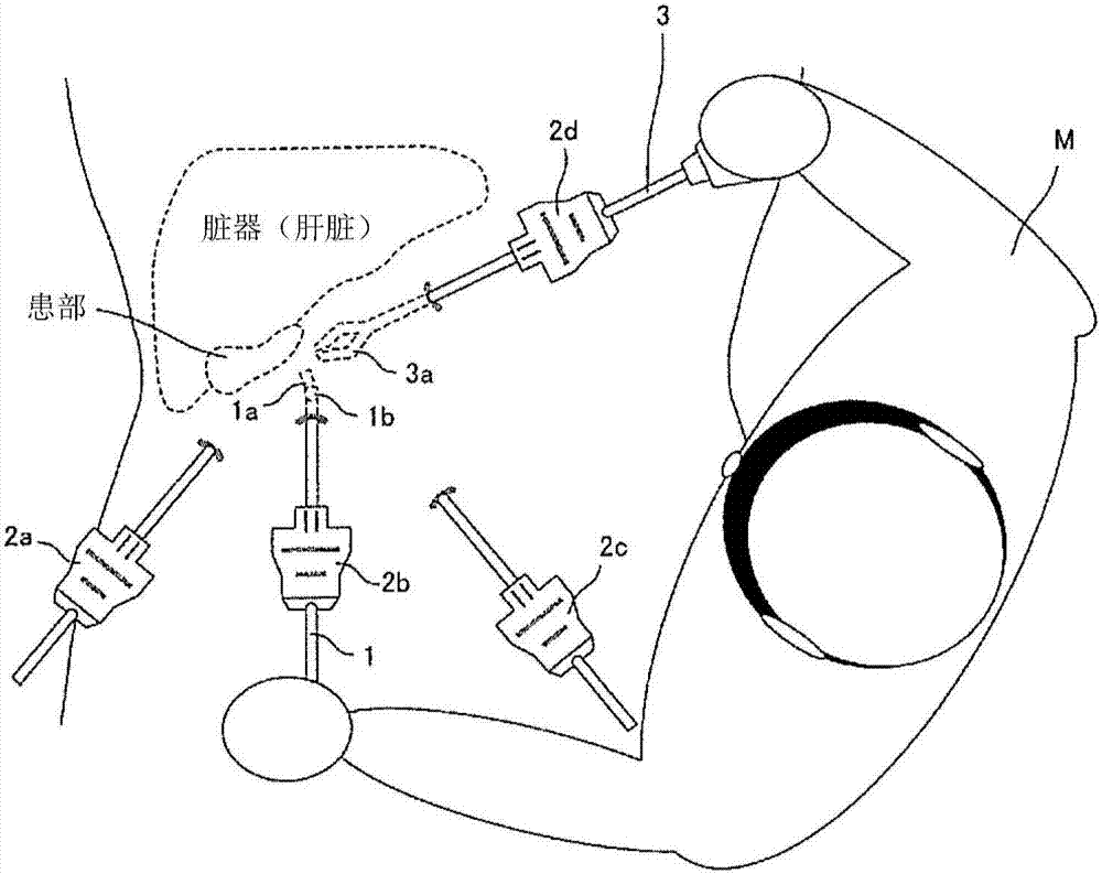 内窥镜系统的制作方法