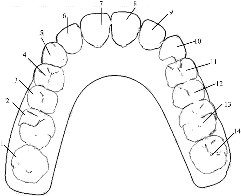 确定牙齿矫治效果的方法,终端及计算机可读存储介质与流程