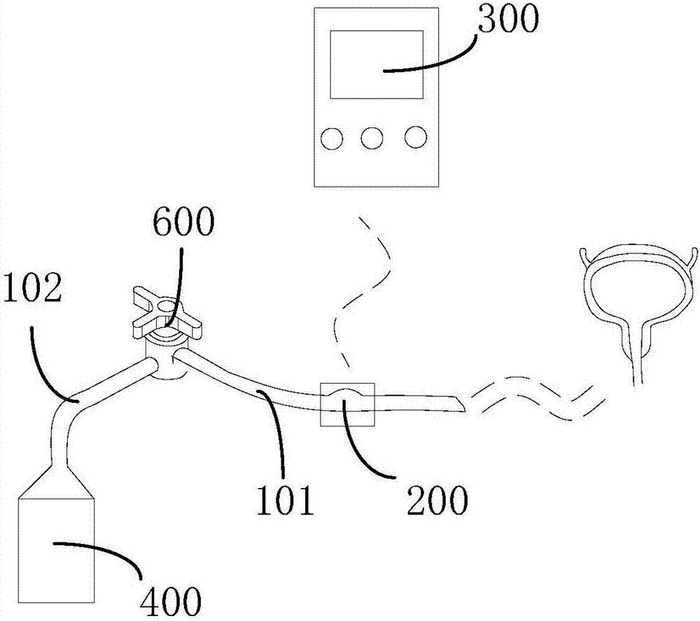 简易膀胱测压装置图解图片
