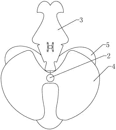 永生型蝴蝶兰的制作方法