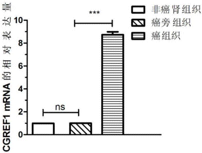 CGREF1作为标志物在肾透明细胞癌诊疗中的应用的制作方法