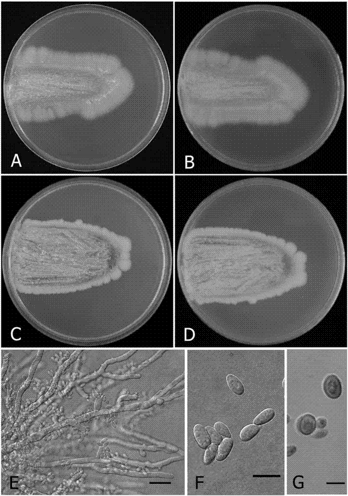 黑酵母菌、生产β-葡聚糖的培养基与方法、以及黑酵母菌培养物与组合物与流程