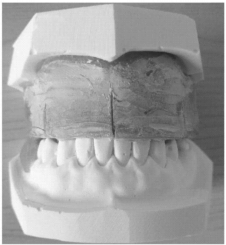 支架式活動義齒cadcam數字化製作方法與流程