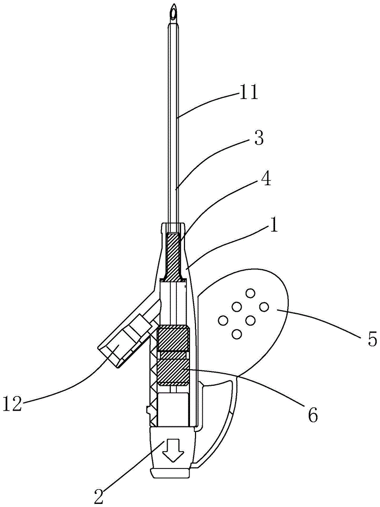 背景技术:静脉留置针又称静脉套管针,其应用是临床输液较好的方法