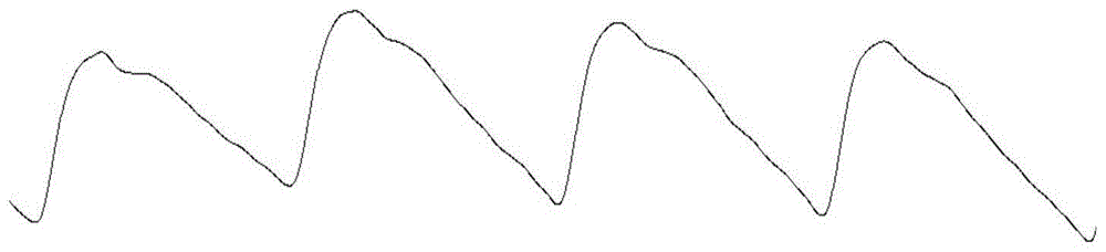 一種脈搏波的處理方法及裝置與流程