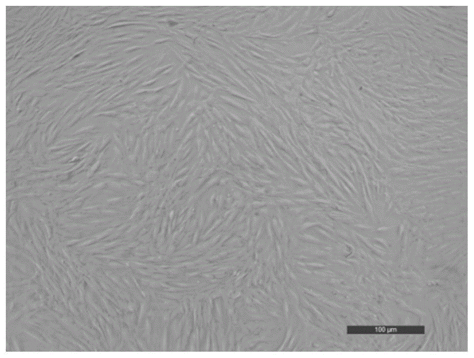 人皮肤成纤维细胞及其制备方法与流程