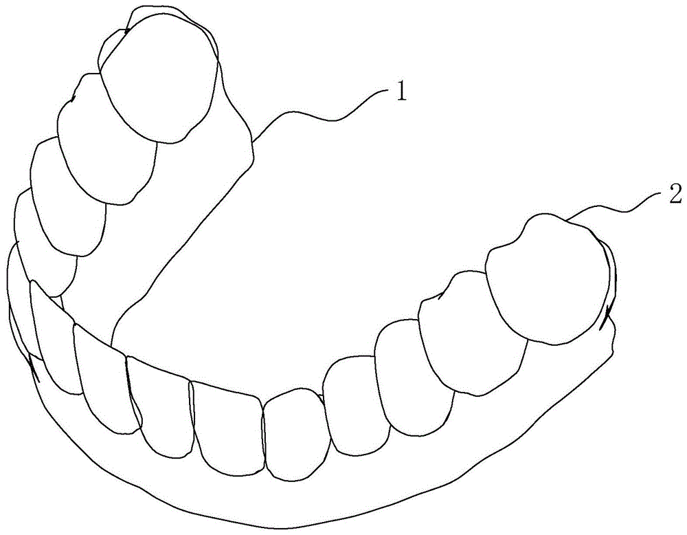 活动义齿设计单画法图片