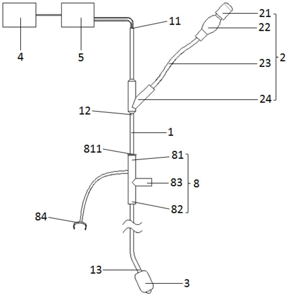 小兒支氣管封堵器的製作方法