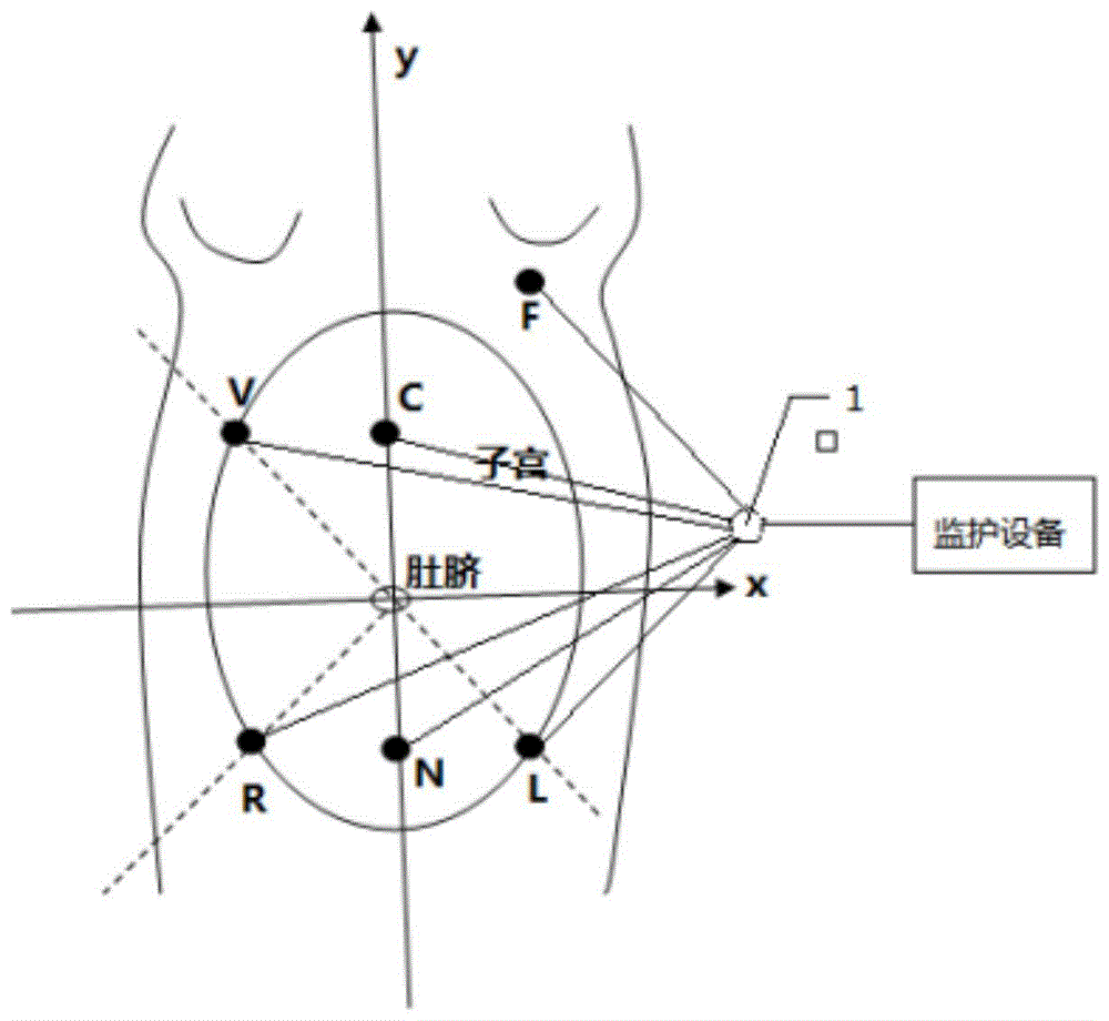 本發明涉及胎兒心電監護技術領域,具體涉及一種電極系統,胎兒心電信號