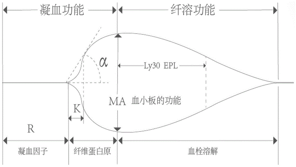 血栓弹力图adp抑制率图片