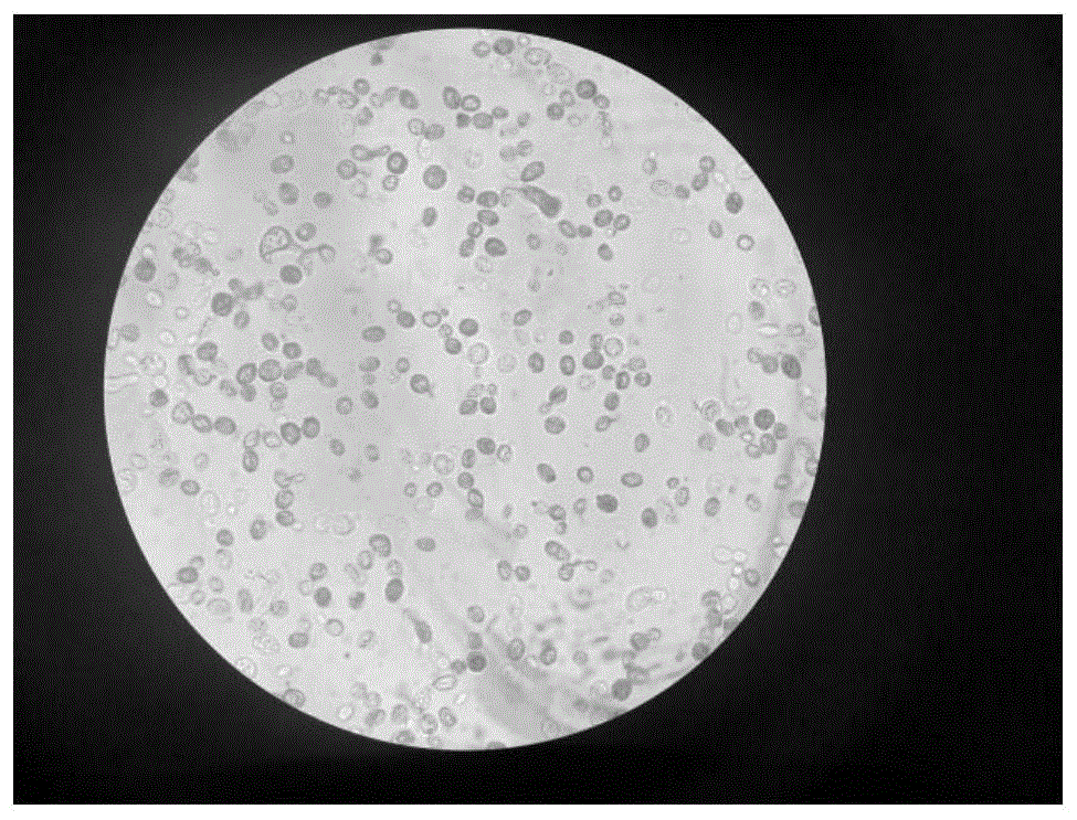酵母菌显微镜下图片