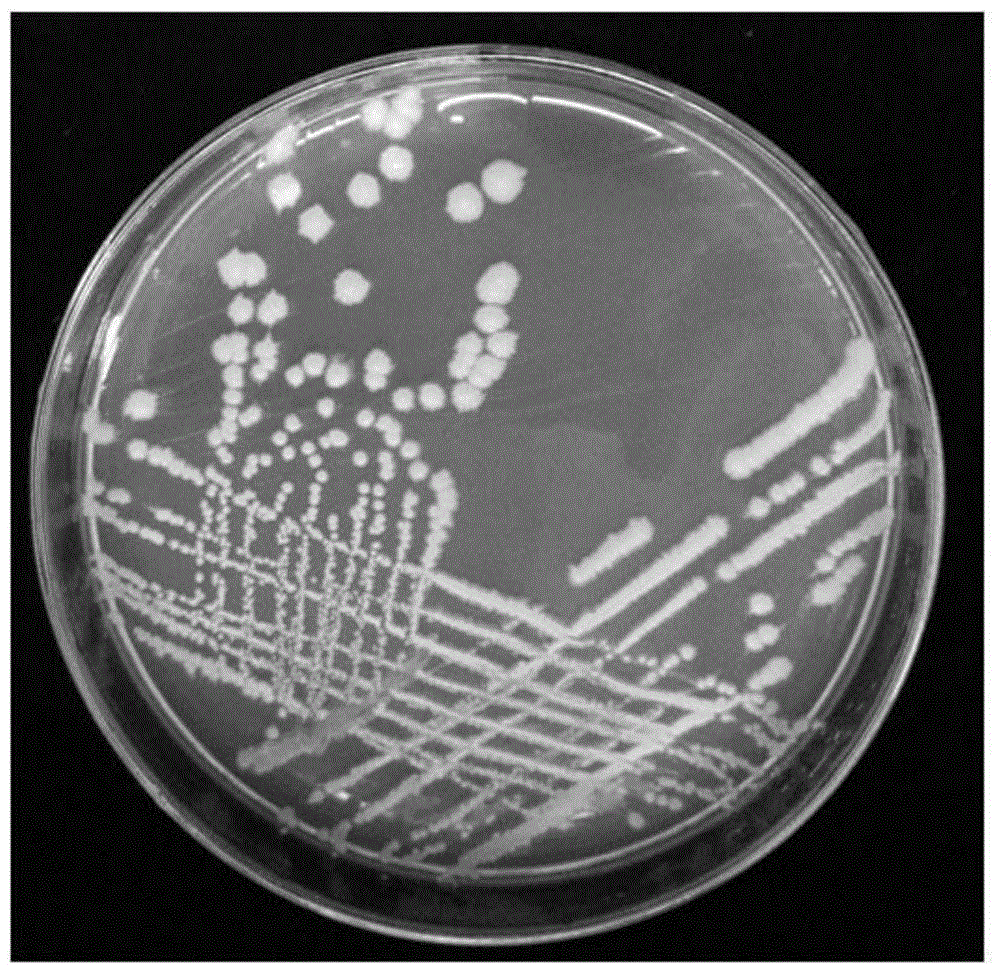 蜡样芽孢杆菌镜检图片图片