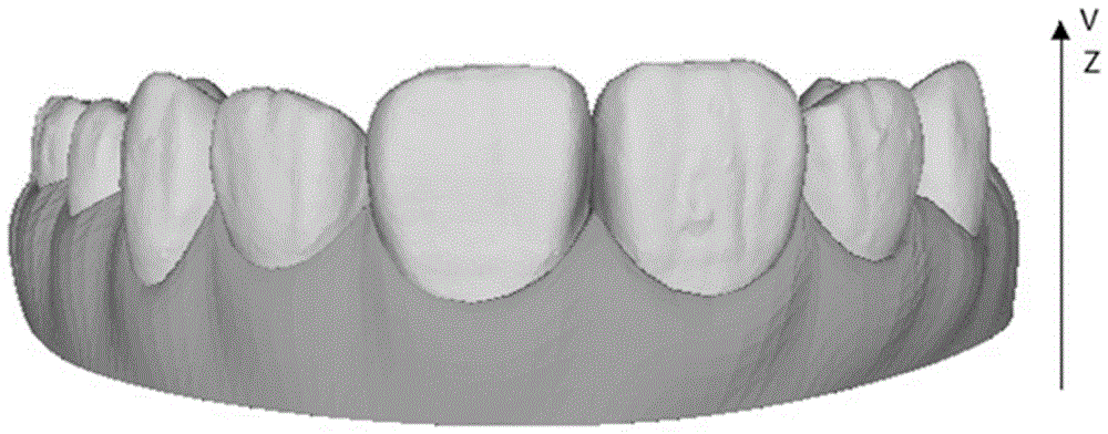 一种基于牙齿特征点的牙齿倒凹自动填充打印方法与流程