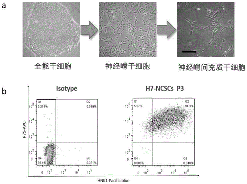 神经异性烯醇化酶偏高_神经元特异性烯醇化酶高多少为癌_肿瘤指标中神经元异性烯醇化酶