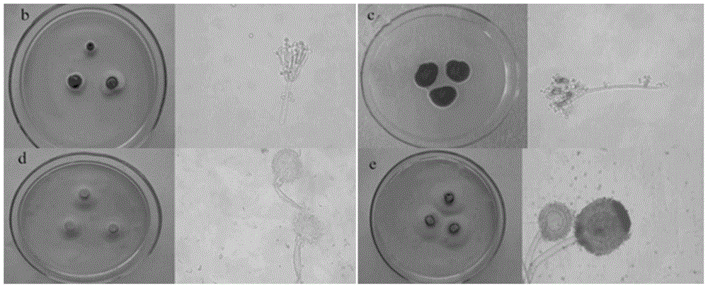 黑曲霉菌结构图片